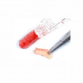 «Легкий» кістковий скребок